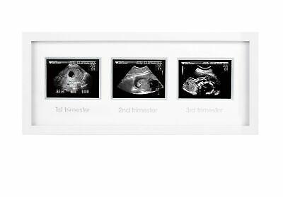 Pearhead Triple Sonogram Pregnancy Frame, Watch Baby Grow Through All Three T...